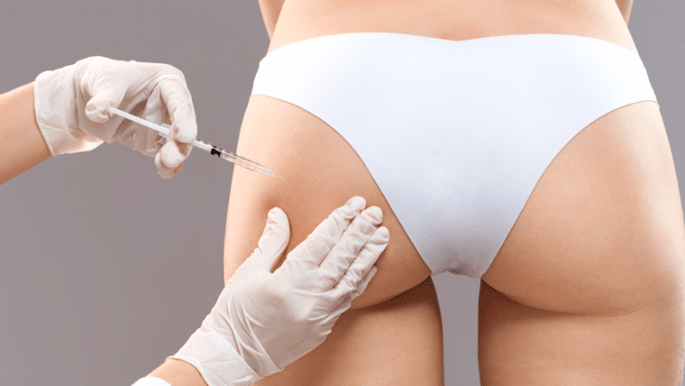 5 Reasons to Get a Brazilian Buttlift